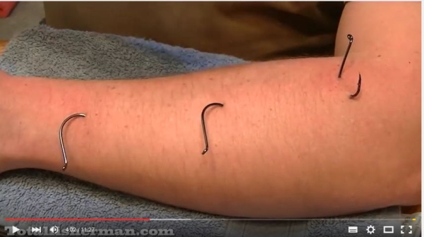 3 ways to remove a hook